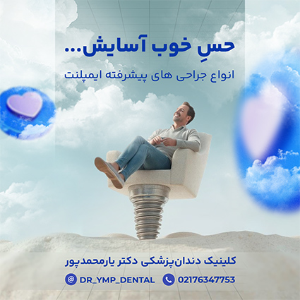 پست اینستاگرام ( تبلیغ ایمپلنت بدون درد و ماندگار)